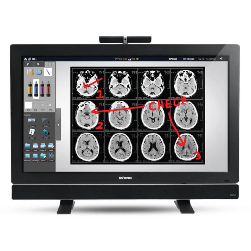 Infocus Inf5520Akit Mondopad Interactive Display Infocus medical display monitor showing grid of brain mri slices with annotation arrows and left side tool panel.